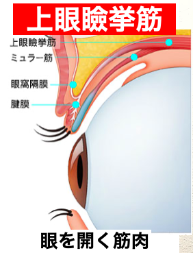 「目が小さくなった？」長年のハードレンズ使用者が直面する眼瞼下垂の真実と2026年最新の治療選択肢
