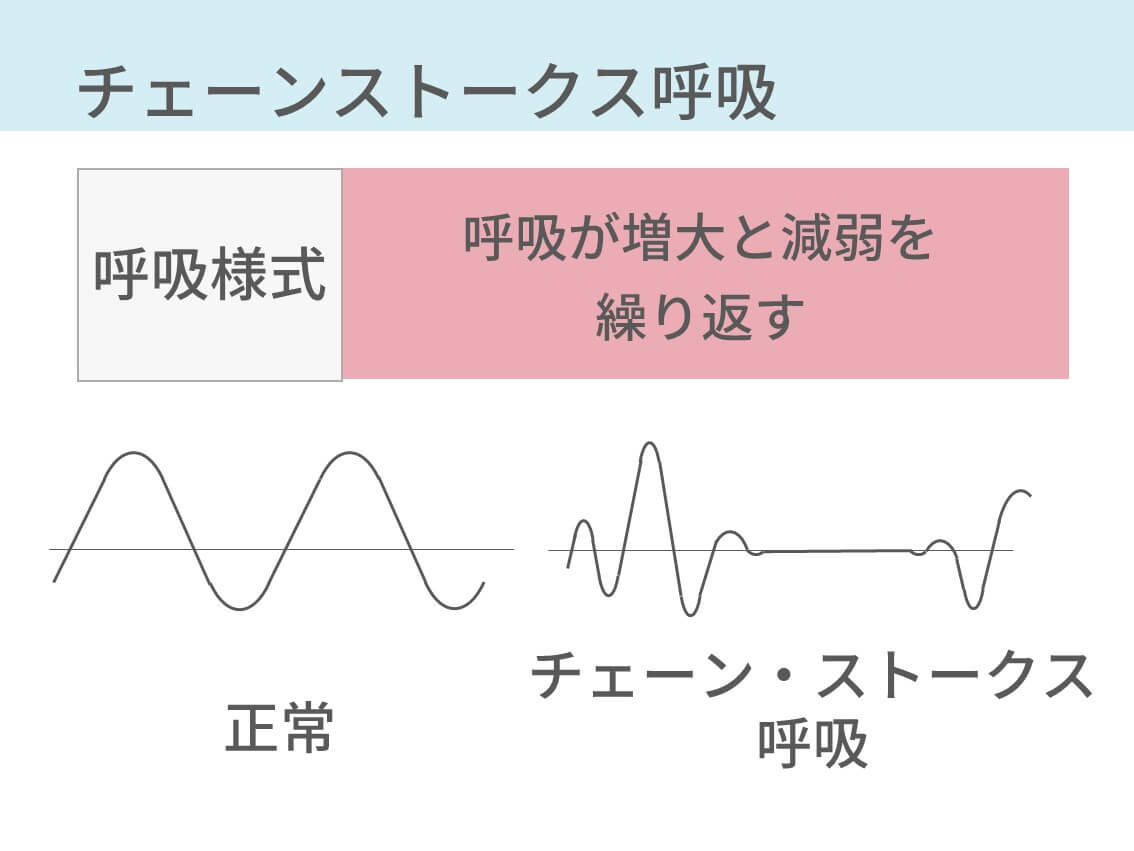 睡眠中に呼吸が止まる「周期パターン」の正体とは？心不全や脳卒中リスクを警告する呼吸異常の最新科学【2026年医療レポート】