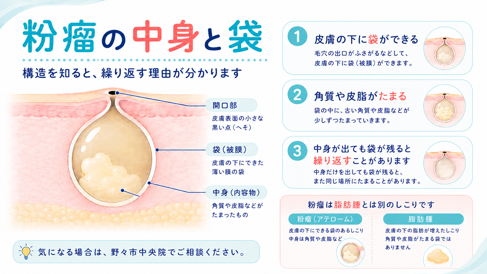 粉瘤が臭い本当の理由と潰す危険性｜皮膚科摘出の全貌