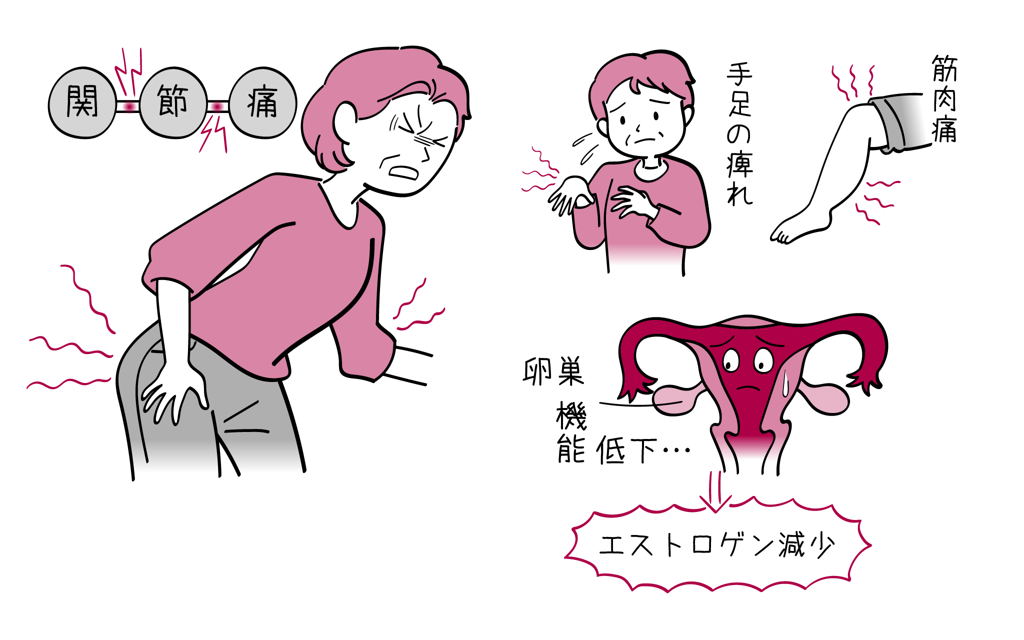 更年期の手足の痛みやしびれ原因は？リウマチとの違いと最新改善策