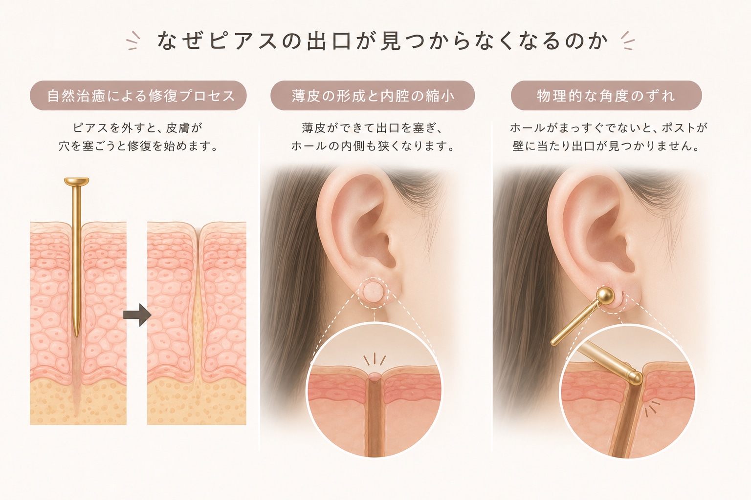 ピアスの出口が見つからない原因と痛まず通すプロ直伝の対処法