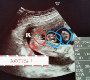 【動画まとめ】 妊娠 性別 女の子 特徴 最新情報まとめ 2026 #936