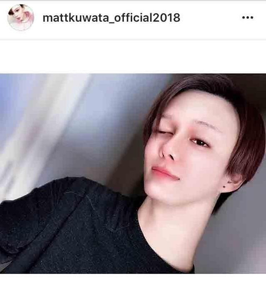 Mattの素顔やすっぴんの真実！高校野球時代の写真と激変の真相