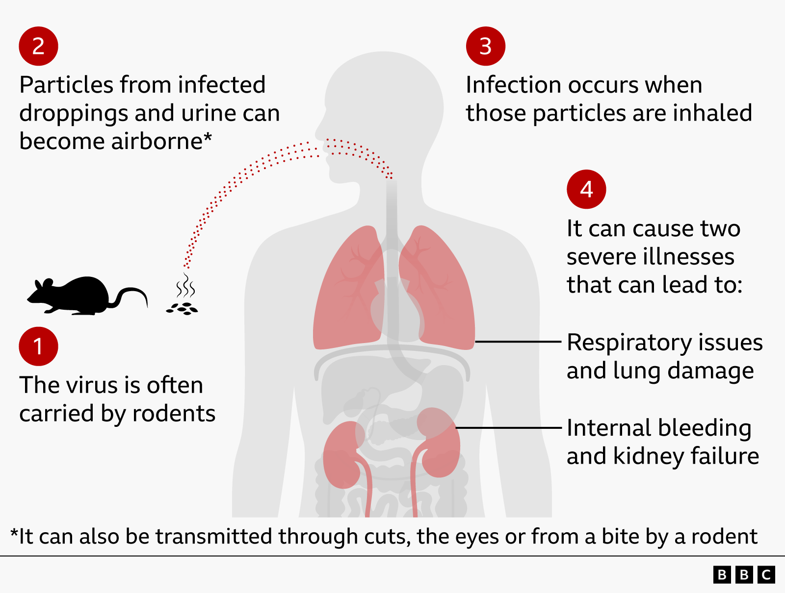 Can You Get Hantavirus in the Uk