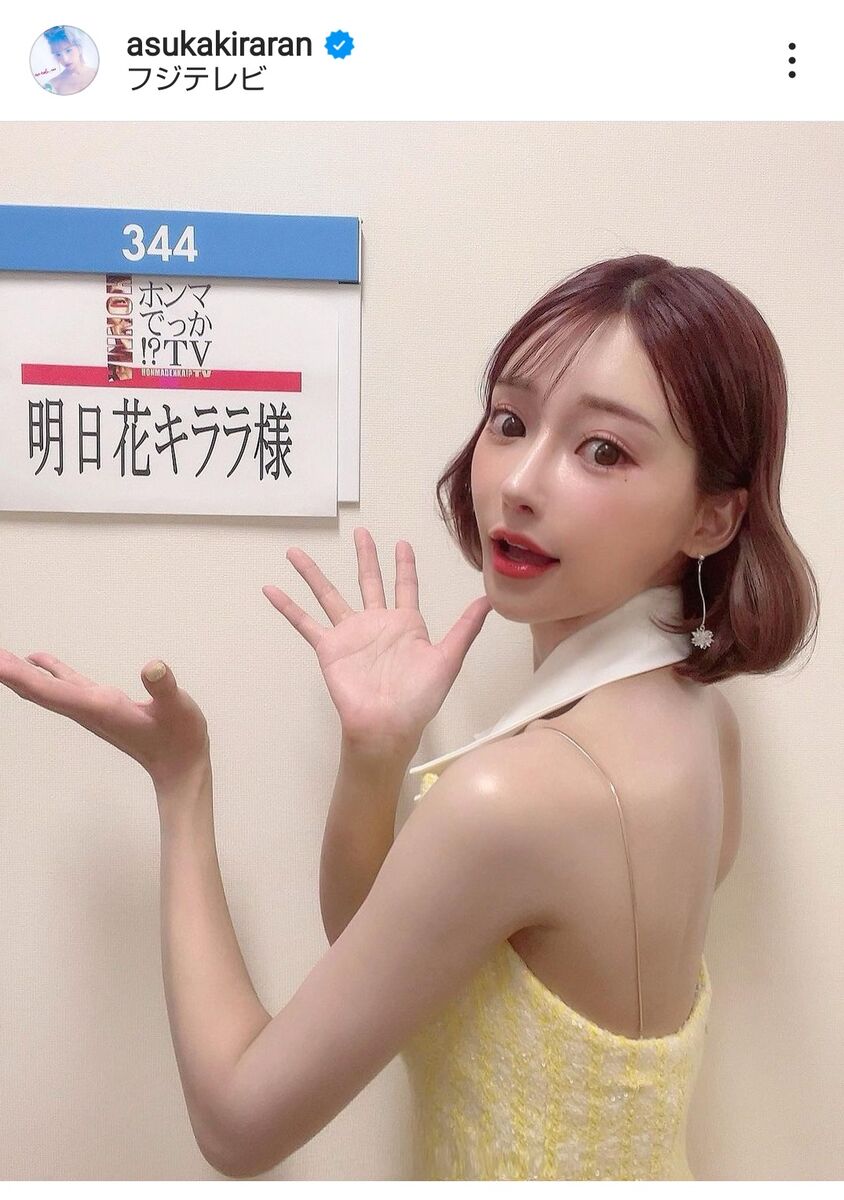 明日花キララ整形総額と執刀医を徹底検証！黄金比フェイスの秘密