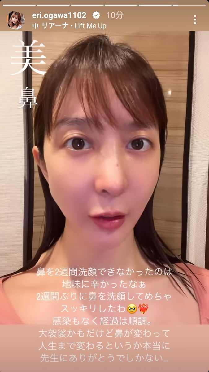 エンリケ整形総まとめ！昔の顔との違いや施術箇所・総額費用まで徹底解剖