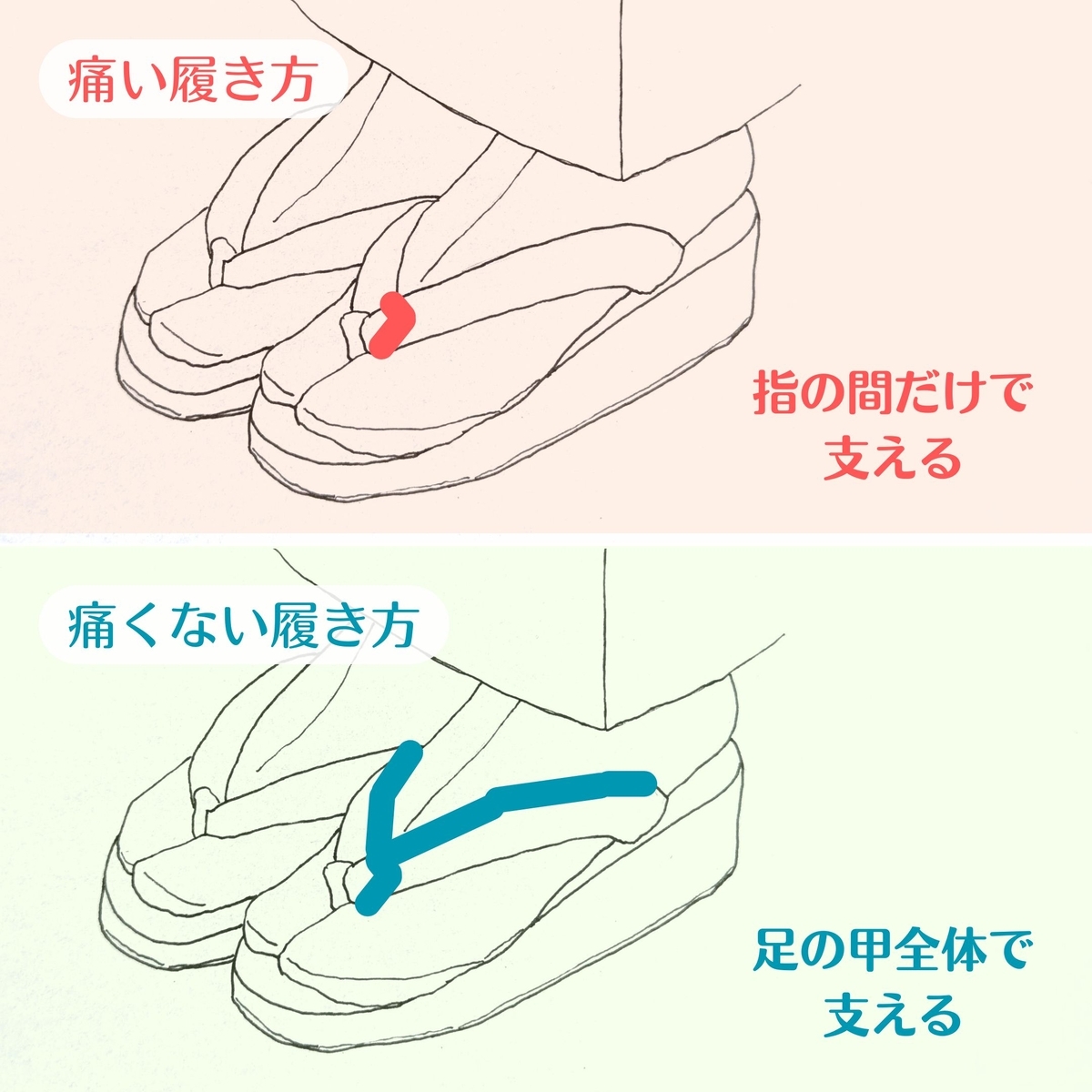 下駄で足が痛くならない方法！鼻緒擦れを防ぐ履き方と事前準備の極意