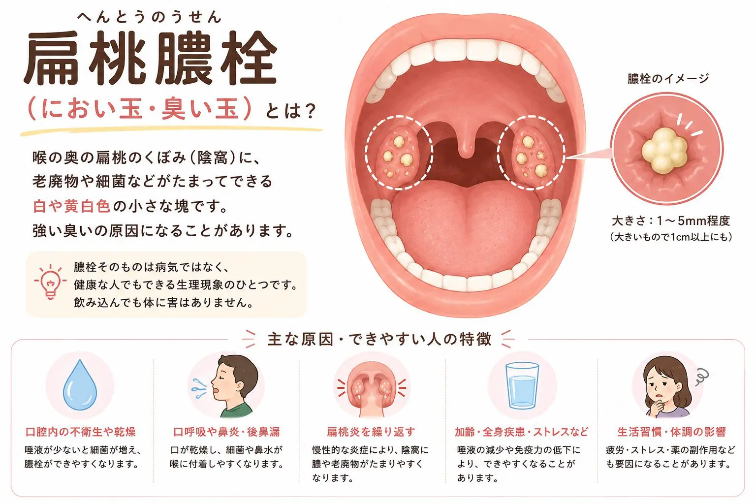 喉の奥の白い塊「臭い玉」の原因とは？膿栓の正体とNgな取り方を徹底解説