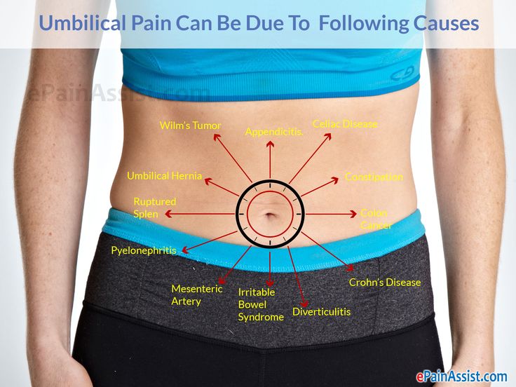 Pain on Right Side of Belly Button Female