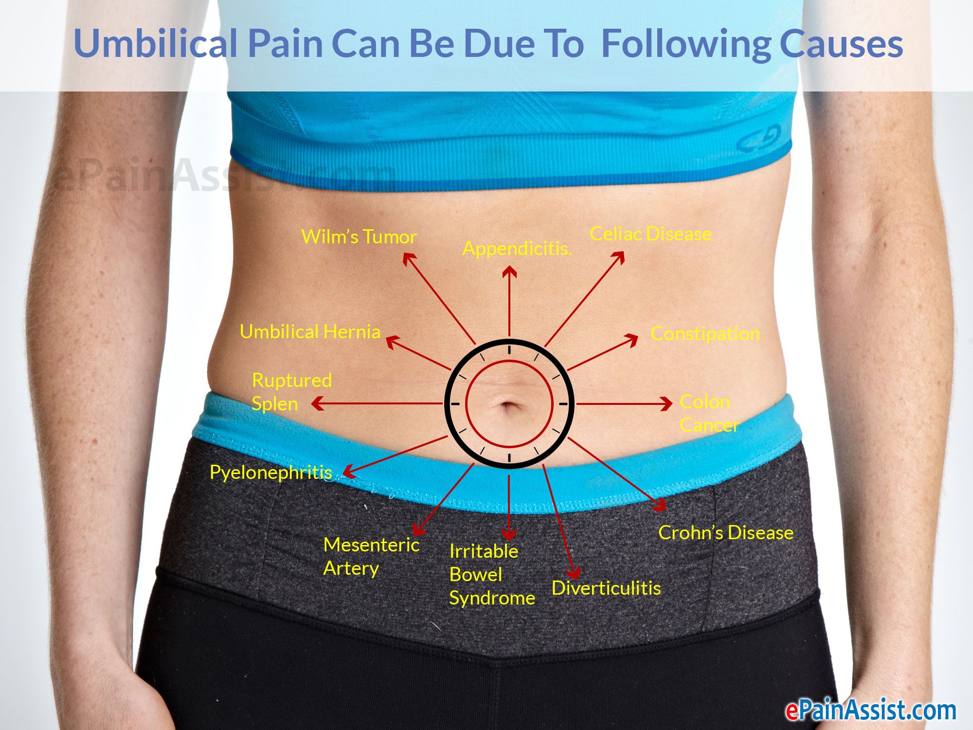 Pain on Right Side of Bellybutton
