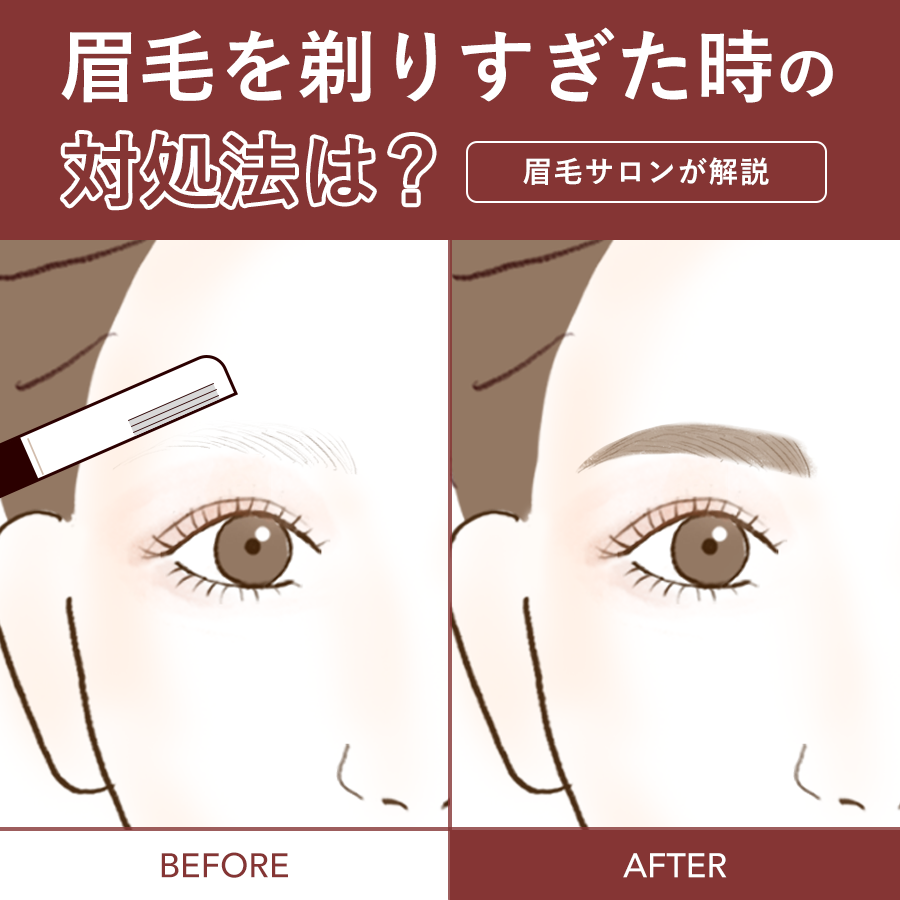 眉毛を剃りすぎた時の緊急対処法！バレずに隠すプロ直伝の再生ガイド