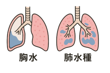 【インスタ画像】 ベイプ 肺 に 水 が たまる 最新画像・動画まとめ #703