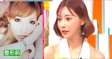 【真相】 明日 花 キララ 整形 前 インスタライブ最新動画 #919