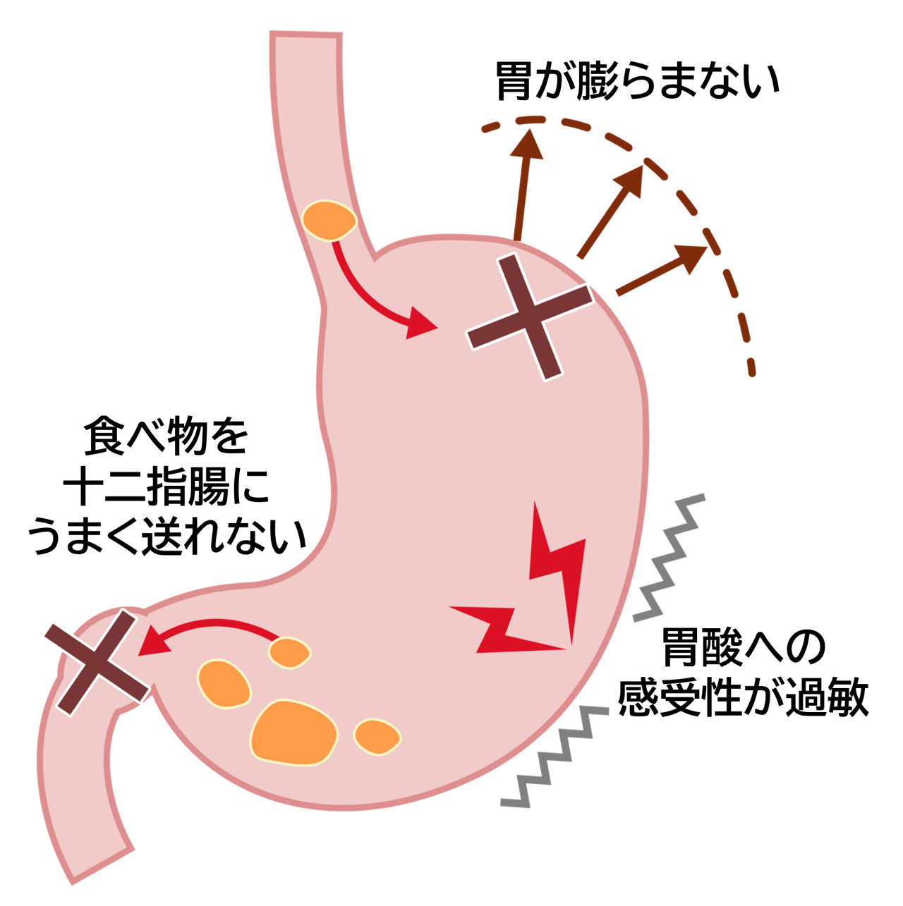 ストレスでみぞおちが痛い原因と危険サイン｜2026最新の対処法