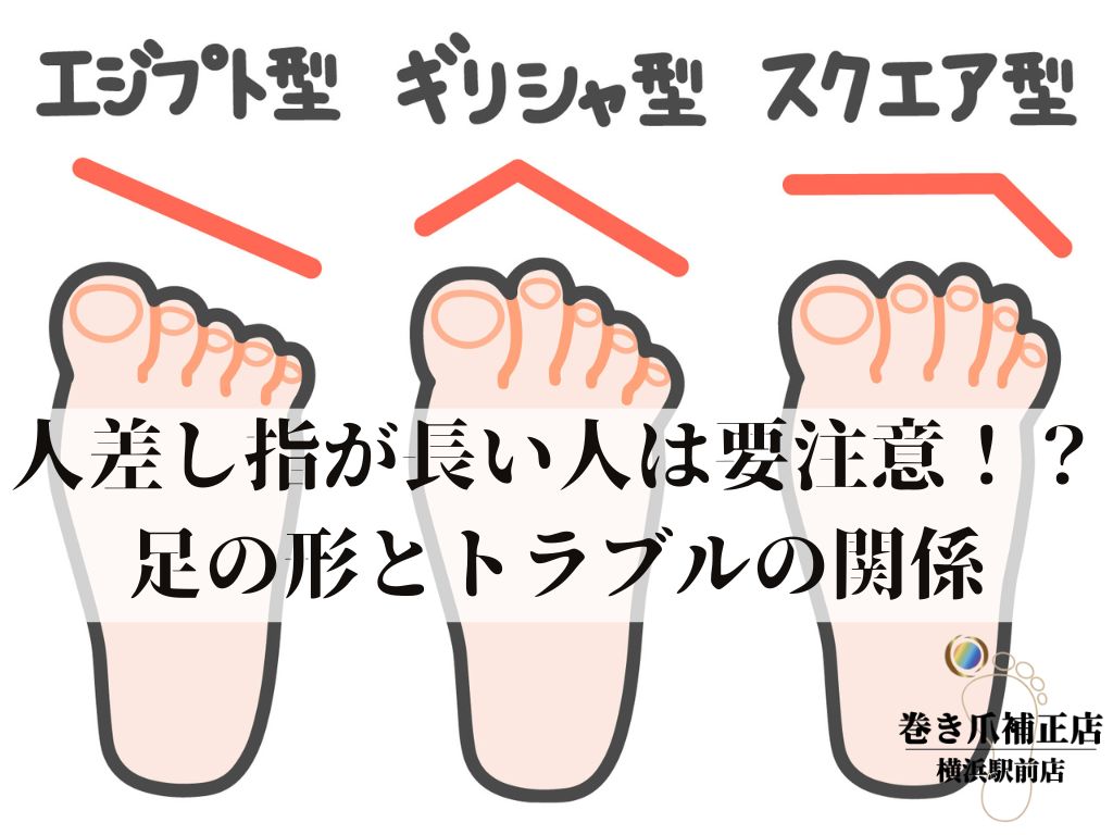 足の人差し指が長い意味とは？親より出世の噂とギリシャ型の真実