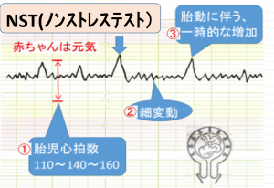 【熱愛】 ノン ストレス と は 徹底解説＆真相まとめ #889