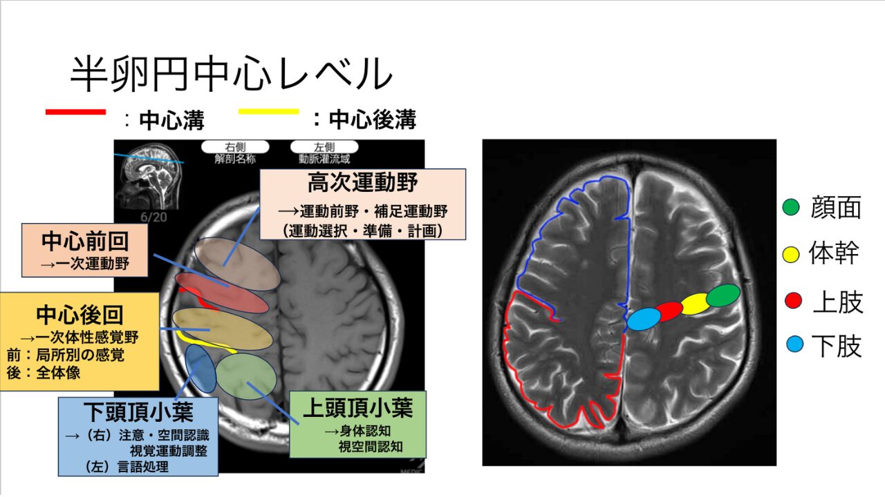 脳画像スライスレベル判別法｜基底核から半卵円中心までの見分け方