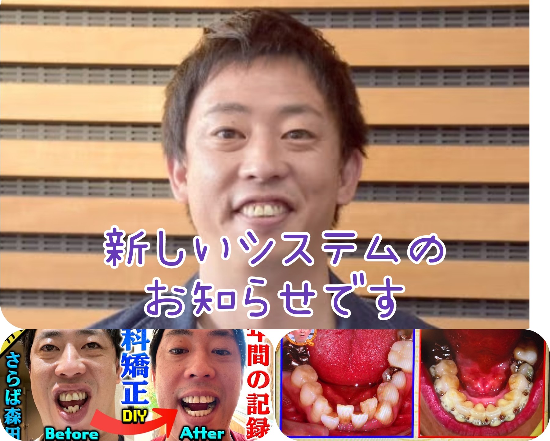 歯科矯正で失敗した芸能人の真相！噛み合わせ悪化と後悔の理由を解剖
