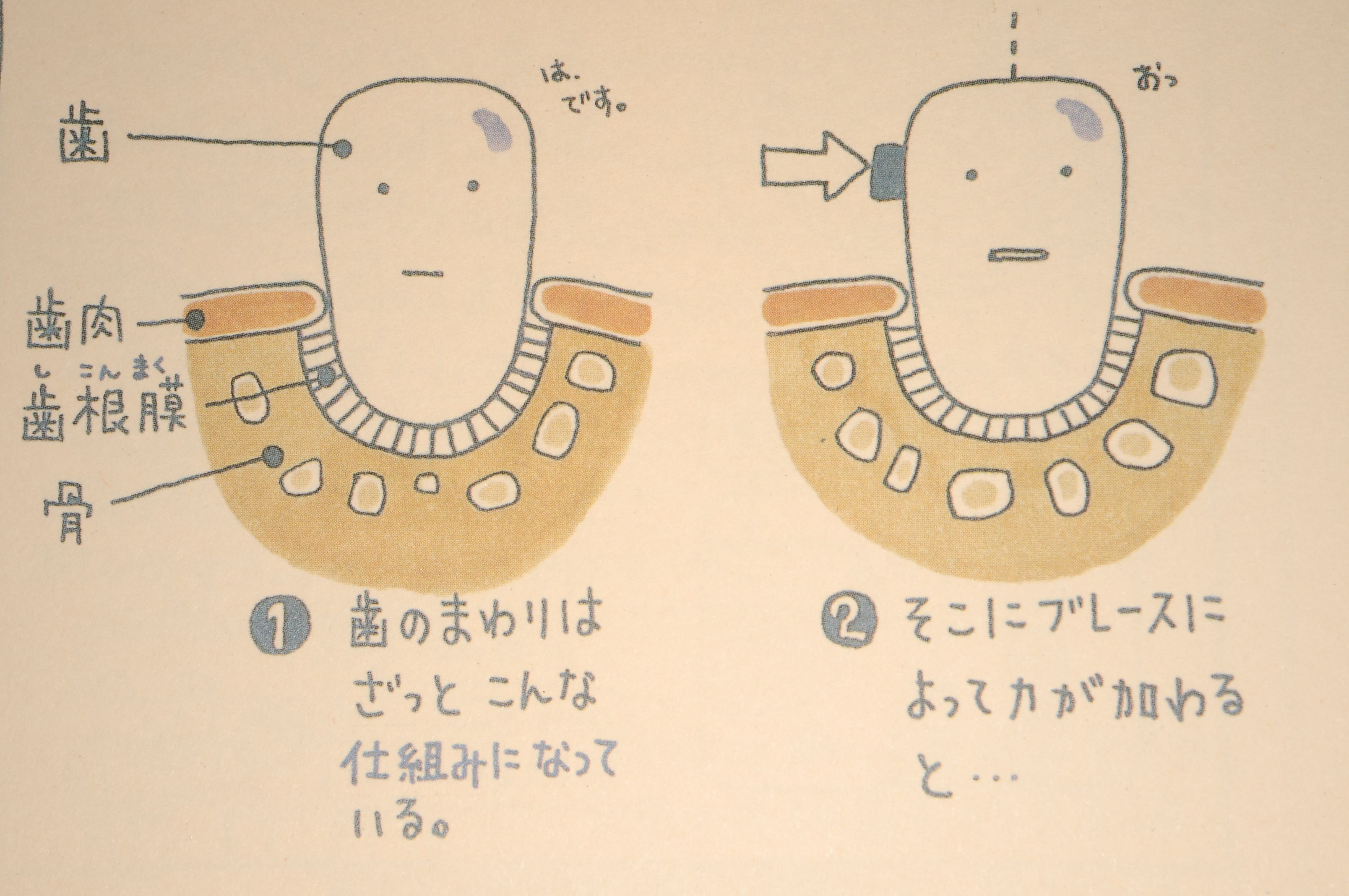 歯列矯正の痛みはいつまで？ピークと後悔しない対処法を徹底検証