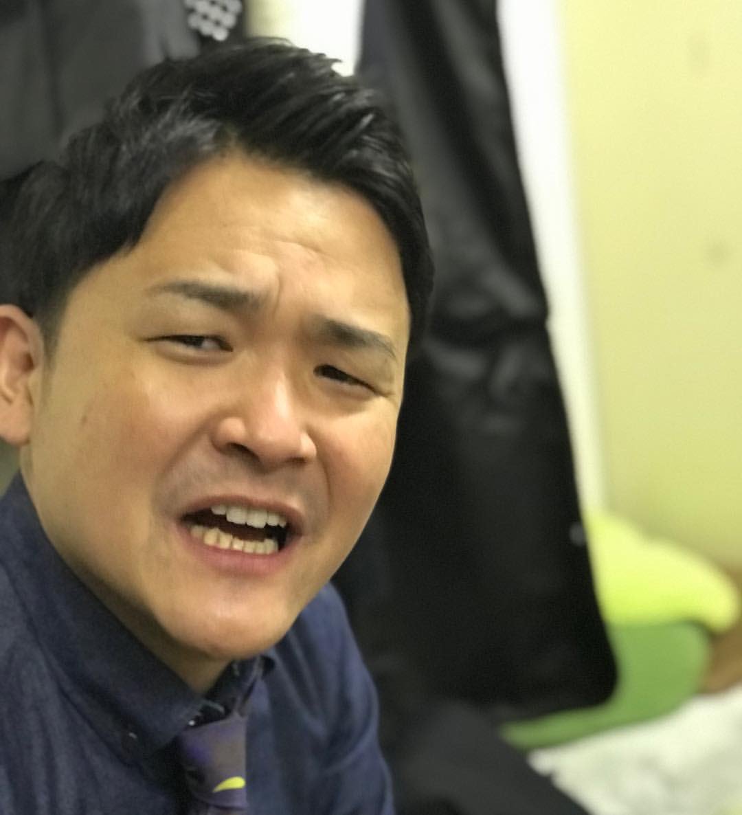 千鳥ノブの顔の噂を徹底追跡！若い頃のイケメン写真と似てる有名人の真相