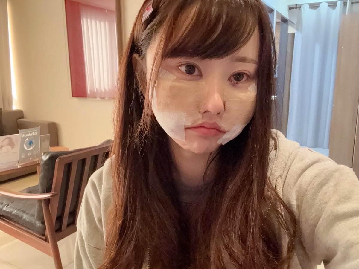 ふわっち配信者まゆの現在と炎上理由｜警察沙汰の真相と最新動向