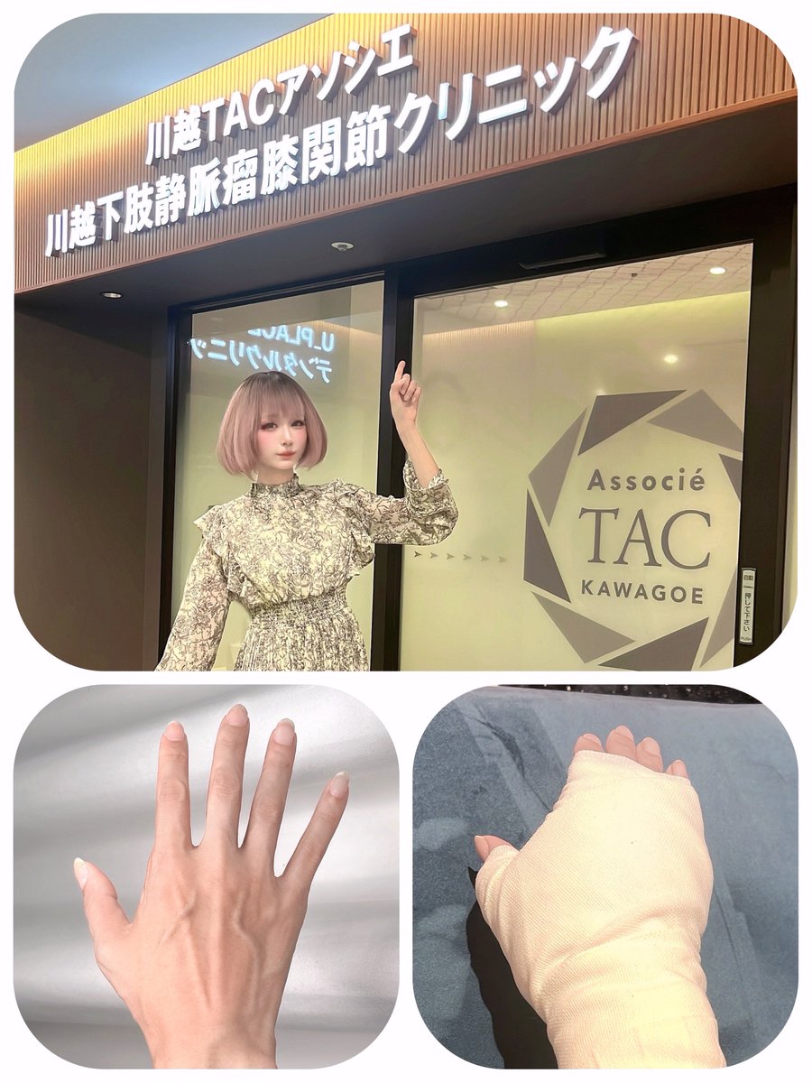 奇跡の40代女装モデル谷琢磨の病気説に迫る！脳梗塞からの復活劇
