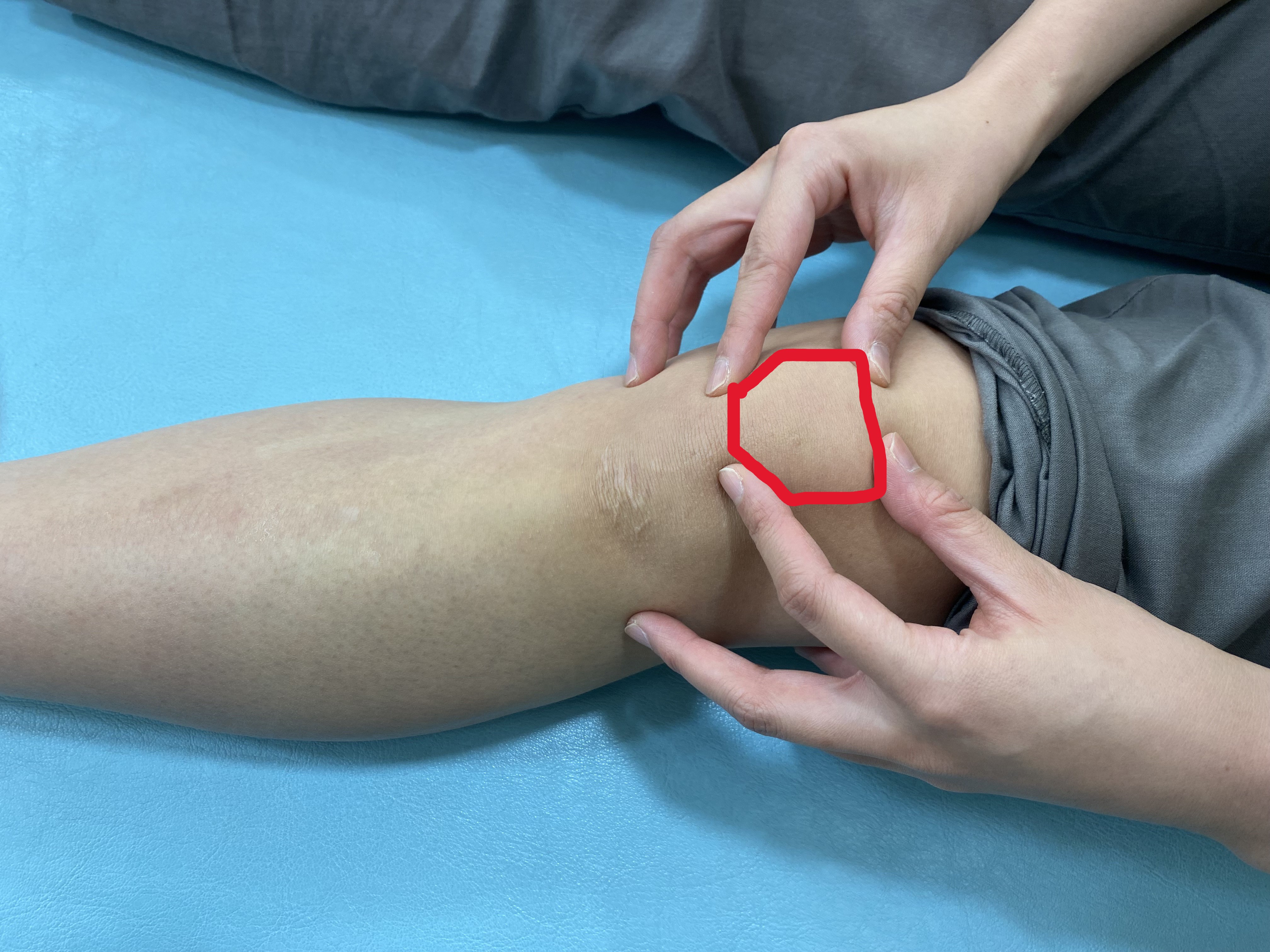 膝の皿が動くのは病気？グラグラ・ポキポキ音の正体と対処法