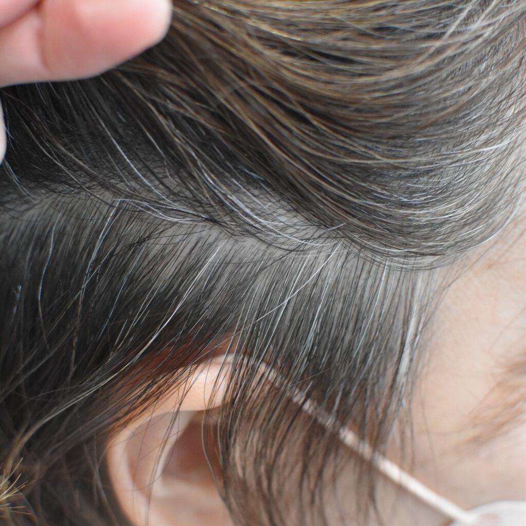 なぜもみあげの白髪は急に目立つ？側頭筋のコリと2026年最新対策