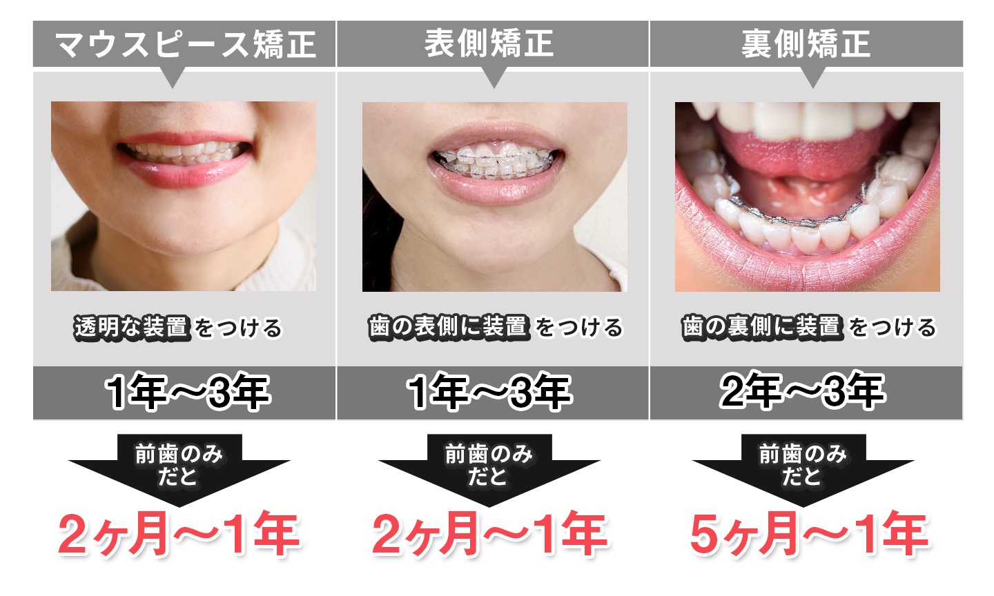 マウスピース矯正で顔は変わる？輪郭激変の真相と後悔を防ぐ全知識