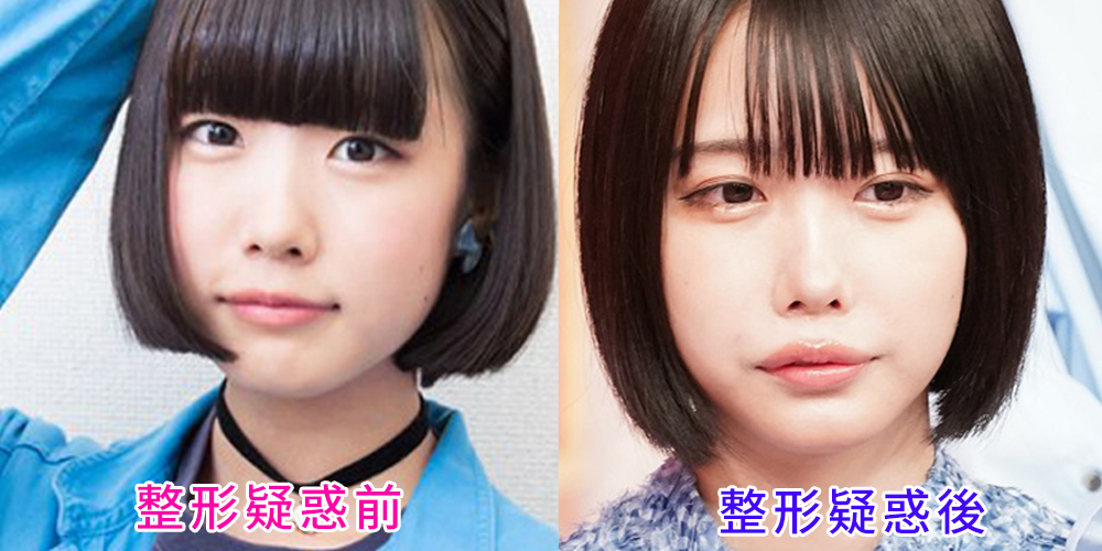 【2026最新】あのちゃんの「整形前」噂は本当か？地下アイドル時代から現在に至るビジュアル激変の真相に迫る