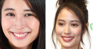 【真相】 広瀬 アリス 顔 変わっ た 衝撃の最新ニュース #835