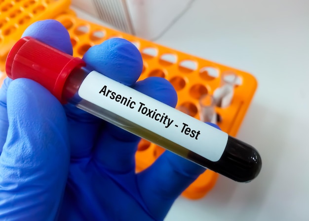 How to Test for Arsenic Poisoning