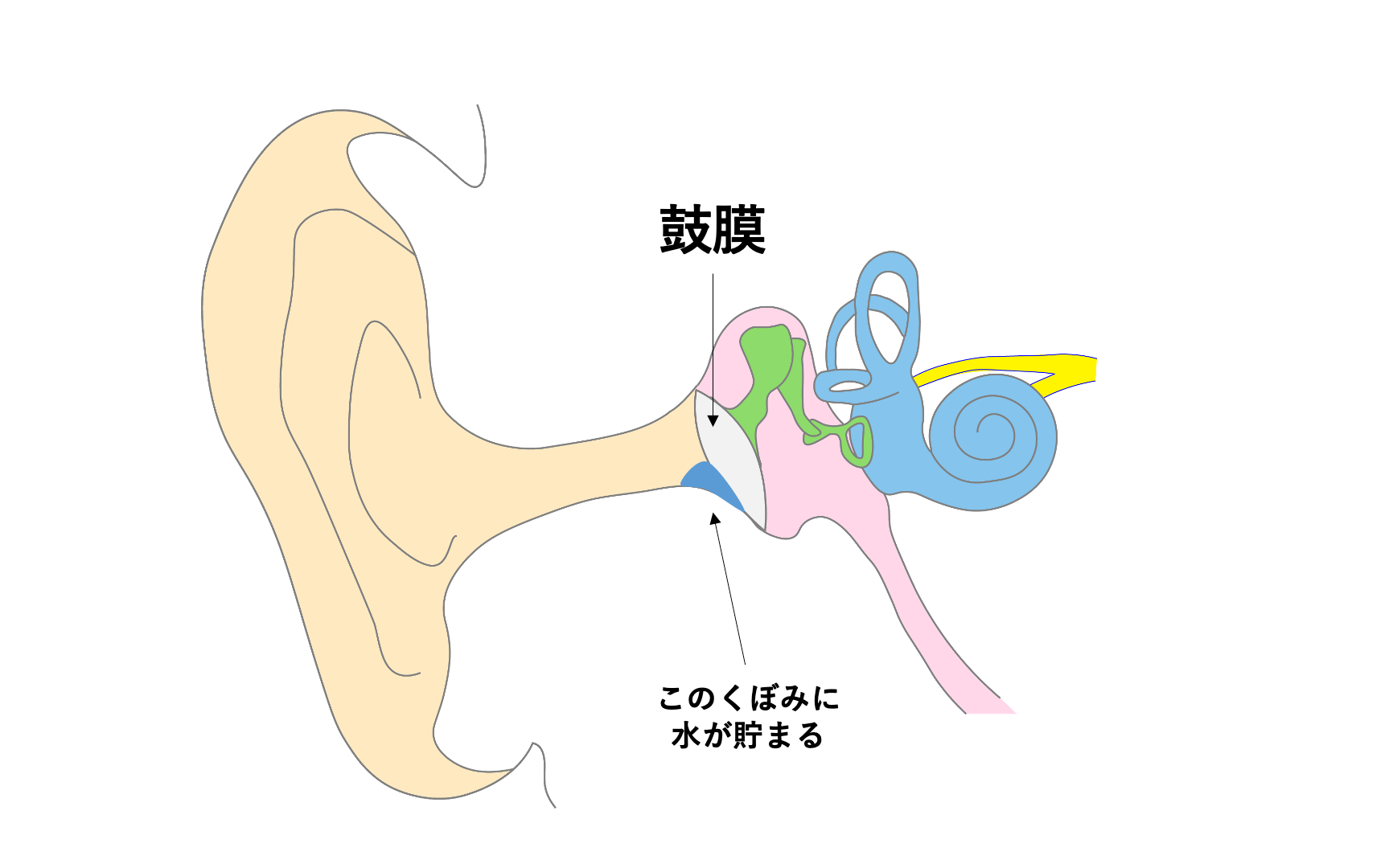 耳の水が取れない！綿棒Ngの理由と表面張力を解く裏ワザ・受診目安