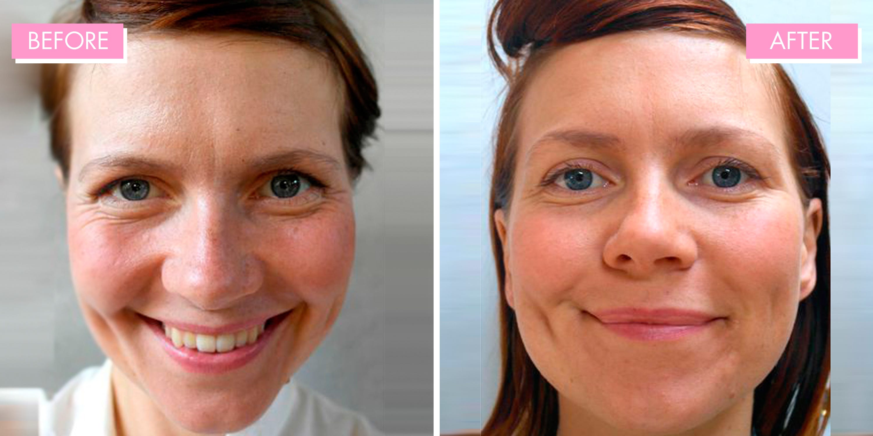 Does Drinking Water Make Your Face Slimmer
