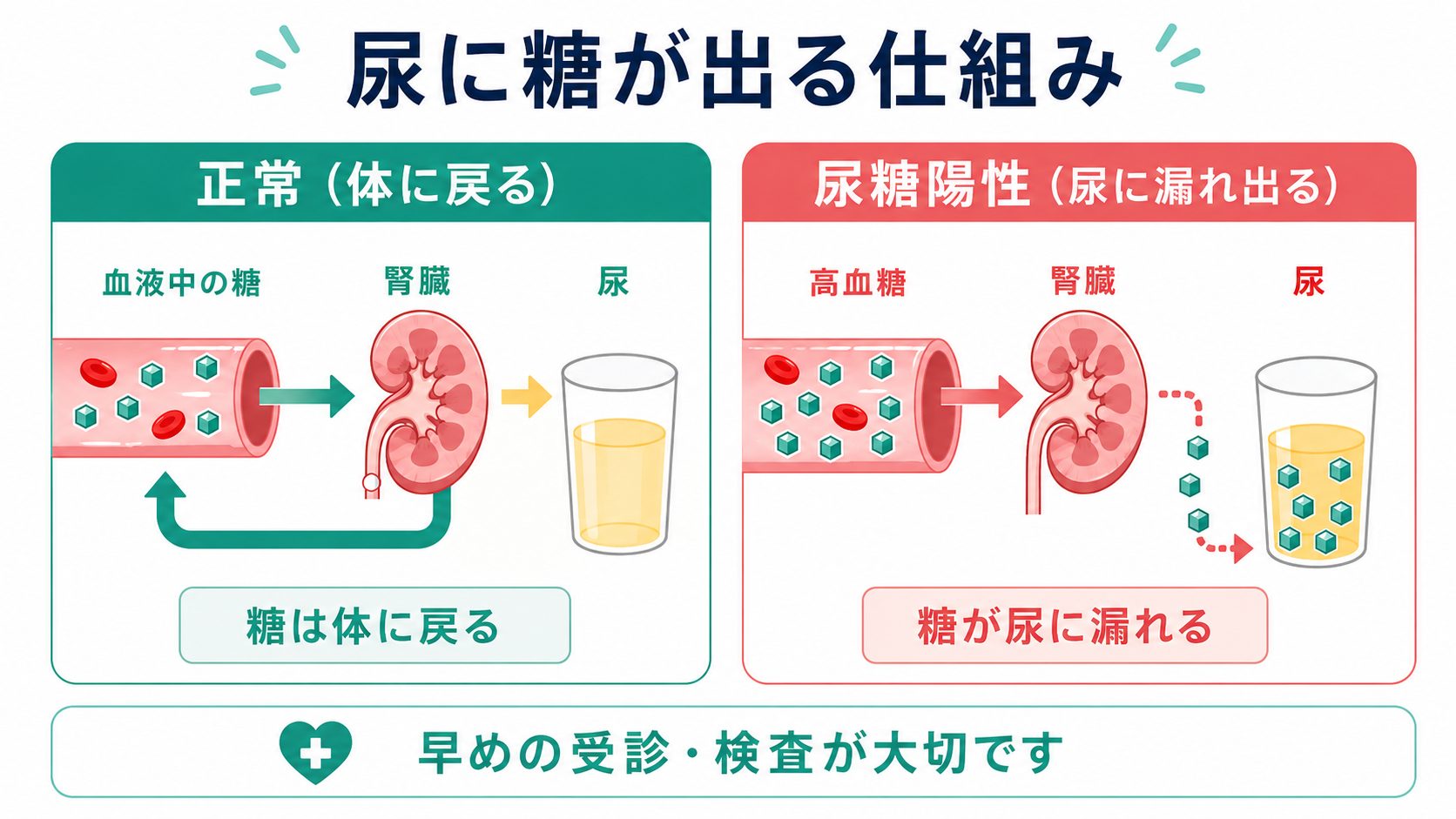 尿に糖が出る原因は糖尿病だけではない？尿糖陽性の真相と正しい対処法