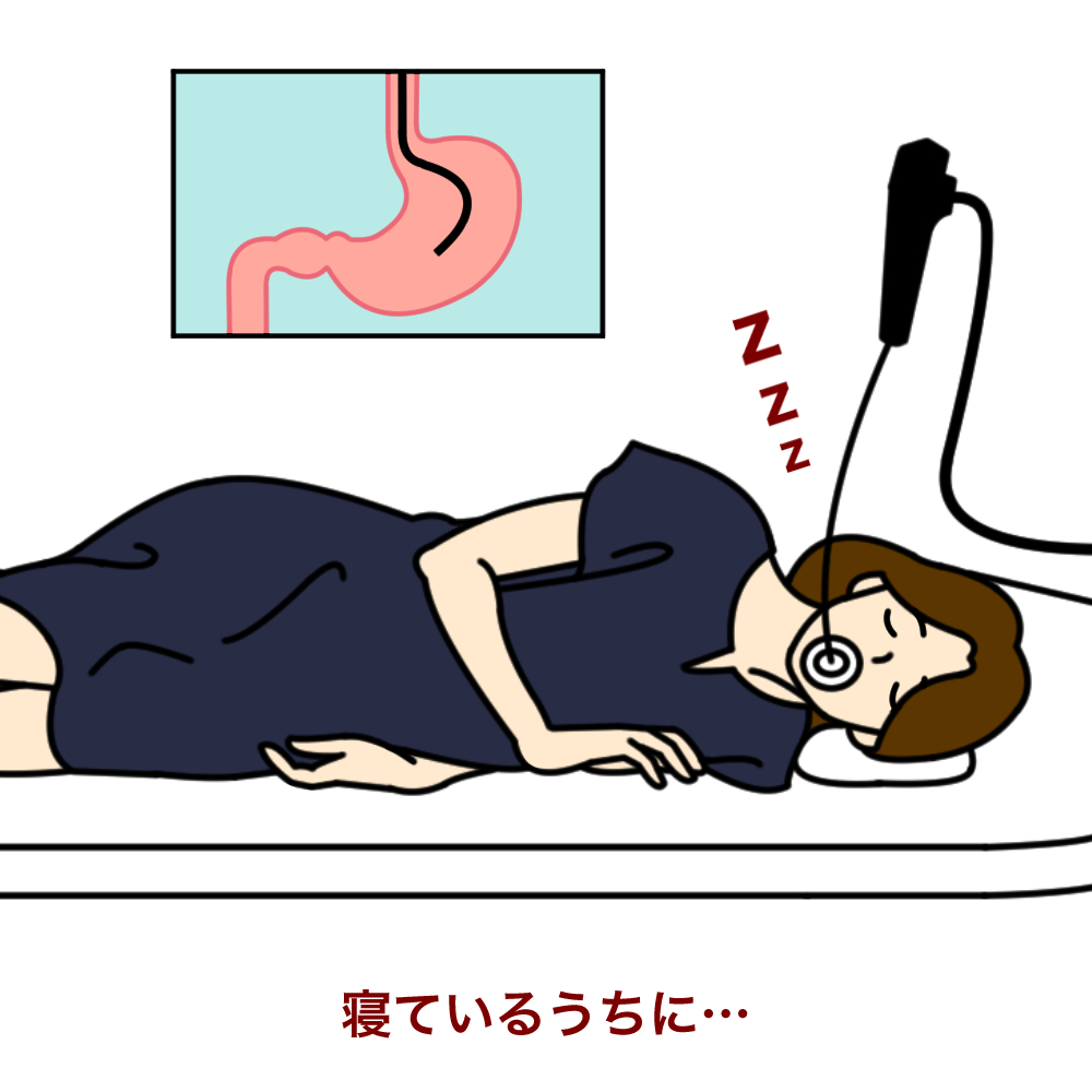 胃カメラの全身麻酔は本当に無痛？鎮静剤との違いや費用・リスク解説