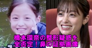 橋本環奈の「顔の変化」を徹底検証：ネットで燻り続ける整形疑惑の真実と、2026年現在のリアルな評価