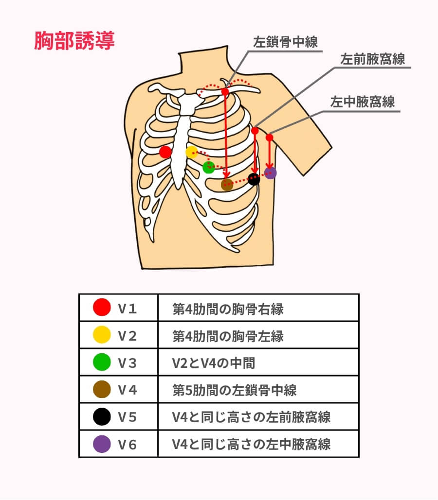 十二誘導心電図が読めない理由とは？電極位置からSt上昇まで徹底解説