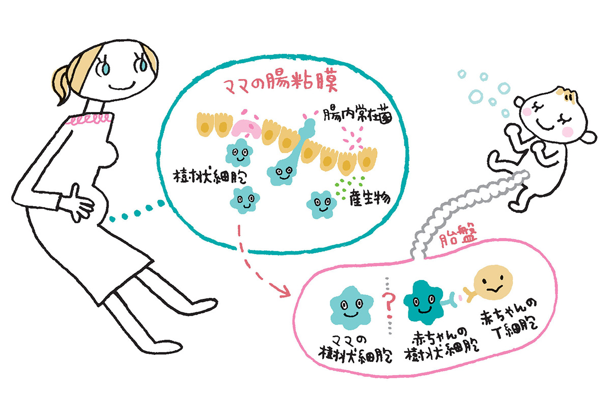 帝王切開で変わる赤ちゃんの腸内細菌｜免疫の真相と最新ケア2026