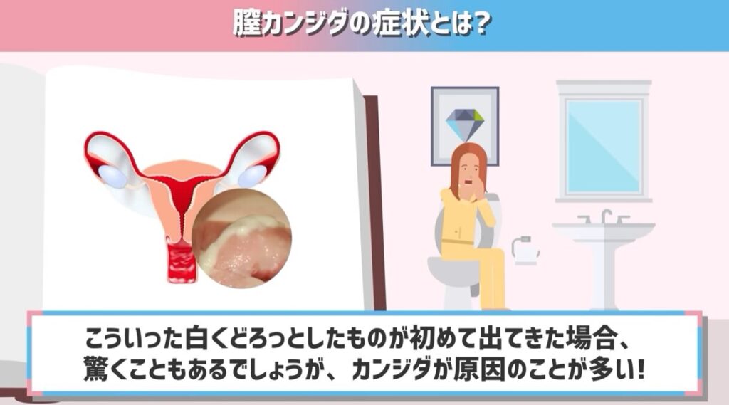 2026年、なぜ「フェムケア」の現場で「膣トレ」が再注目されているのか？ 医療現場と最新テクノロジーが切り拓くヘルスケアの最前線