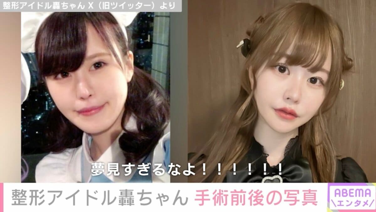 轟ちゃんの整形前と現在の全貌｜総額1400万超の施術と劇的変化の真相