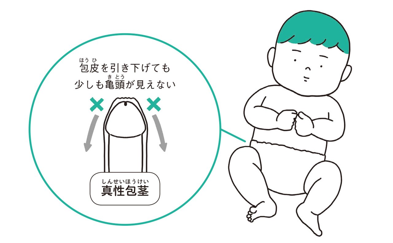 小学生男児の皮むき時期はいつ？無理は厳禁！小児科医が教える新常識