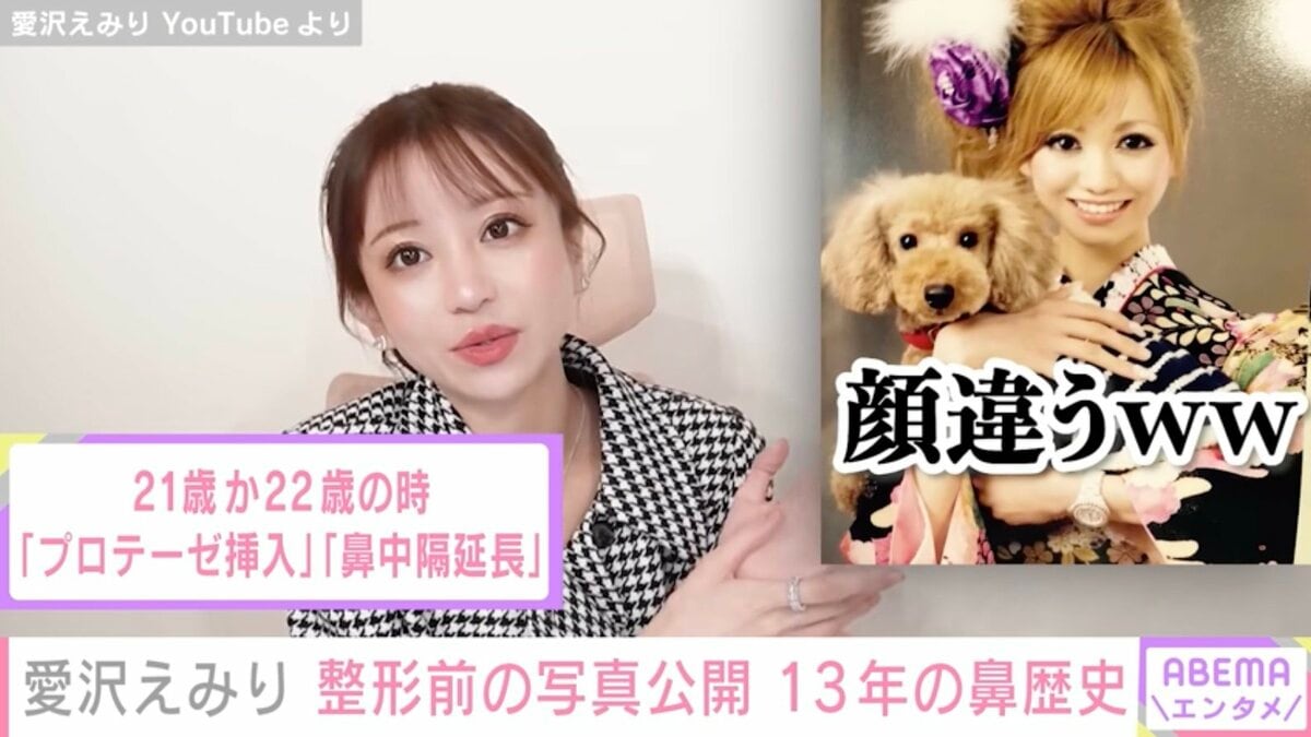 愛沢えみりの整形前と現在の顔を比較｜公言箇所や戻した理由を徹底検証