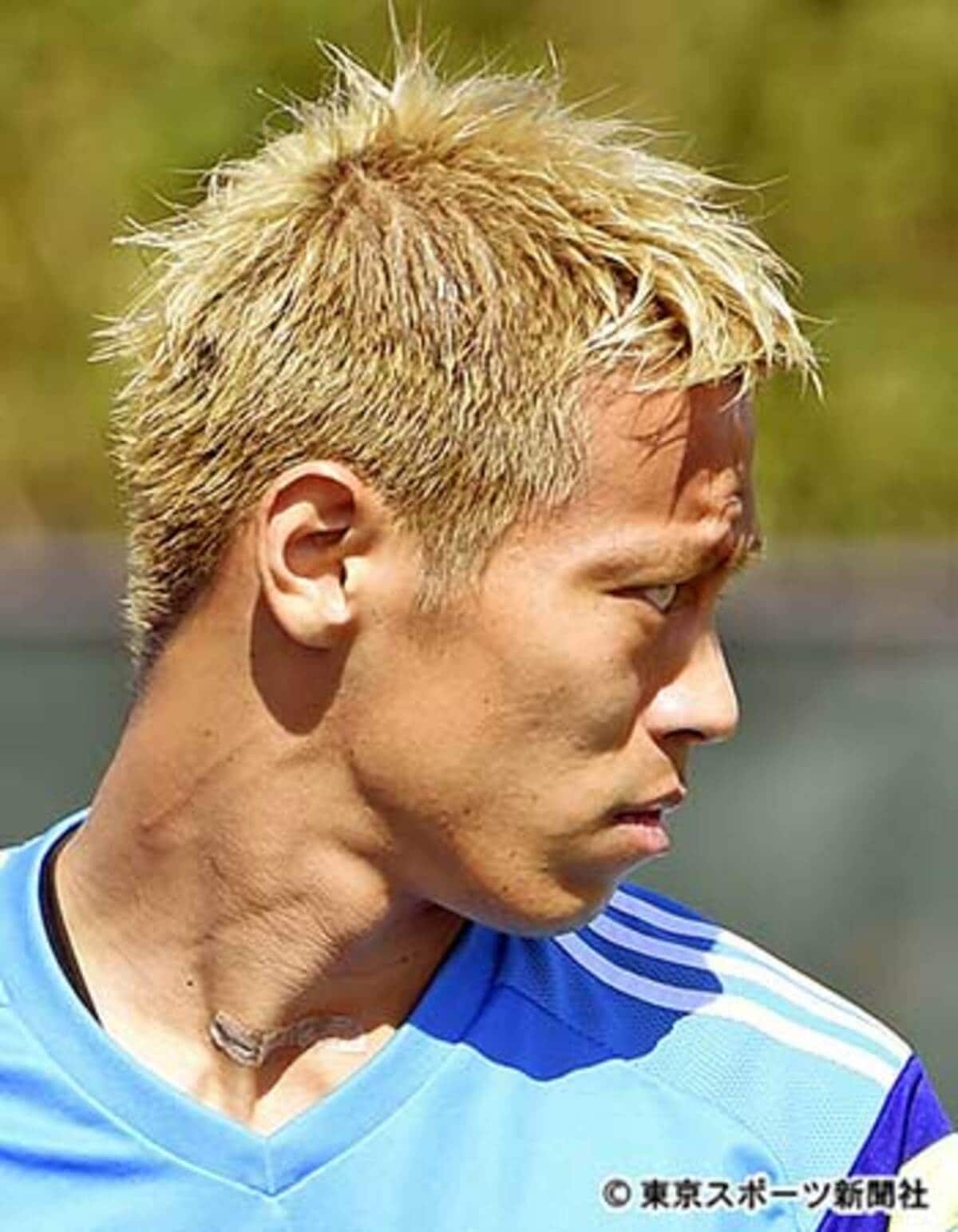 本田圭佑のバセドウ病疑惑とは？首の手術痕と目の変化・現在の真相
