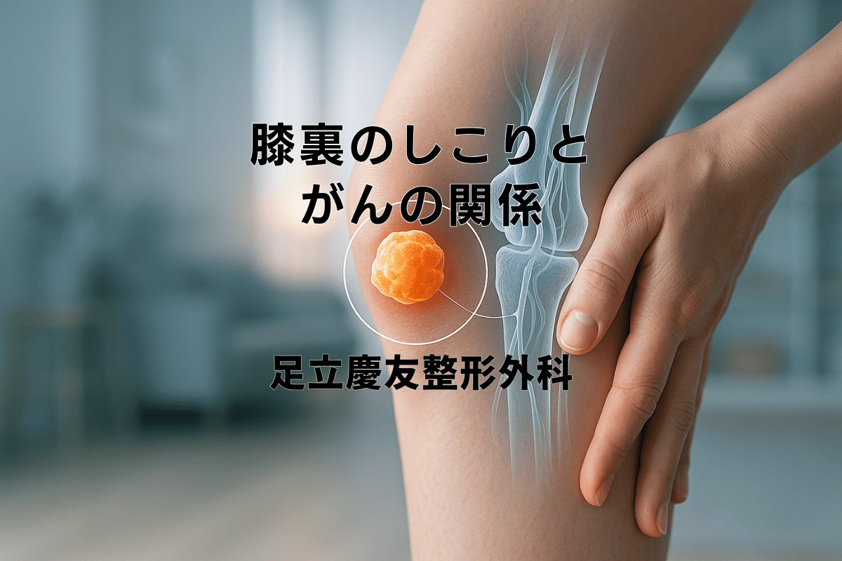 膝裏のしこりはがん？痛くない腫れの正体と受診の目安を徹底検証