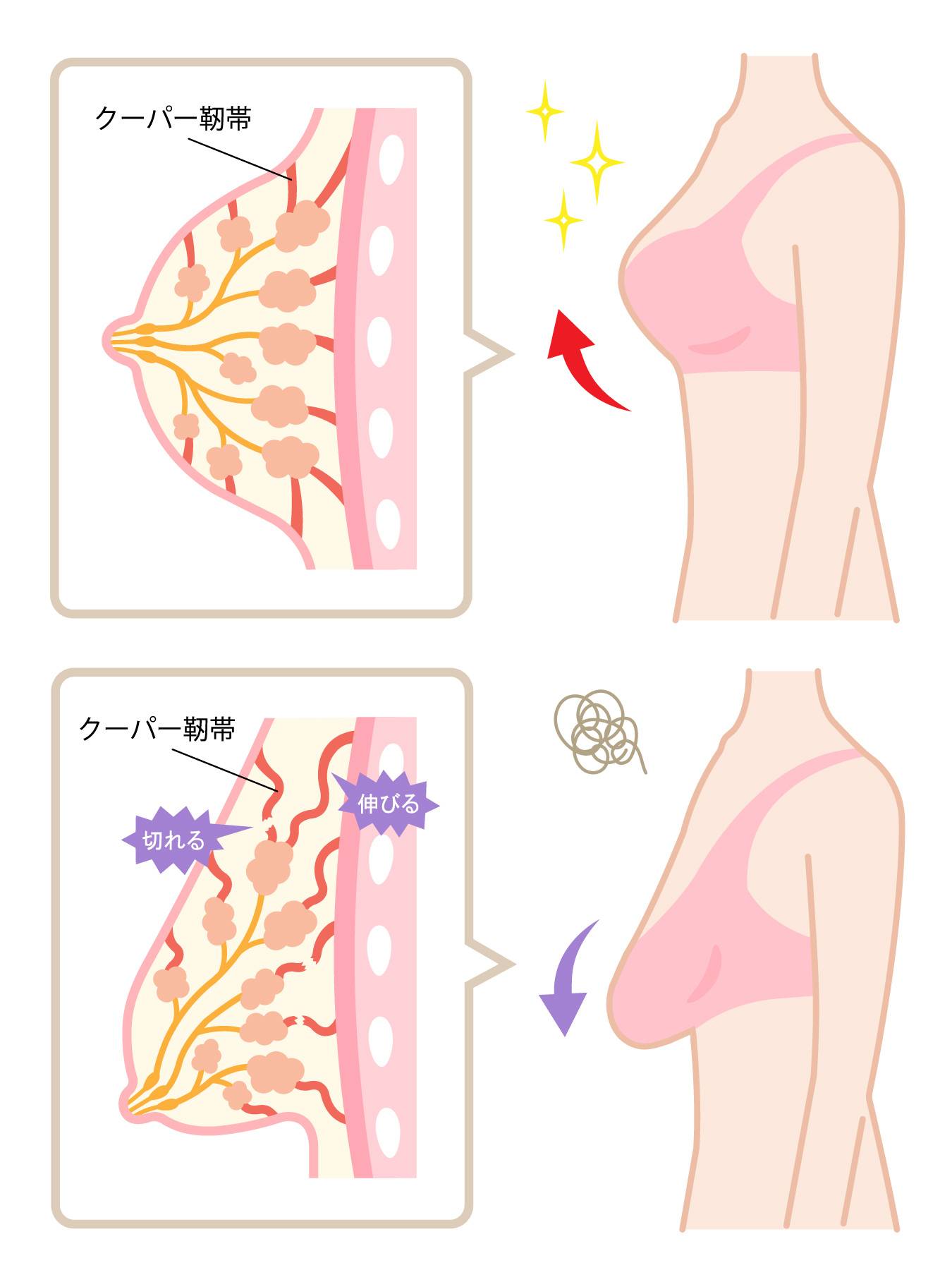 ブラジャーしないと垂れる噂は本当？バスト下垂の真相と最新美胸ケア法
