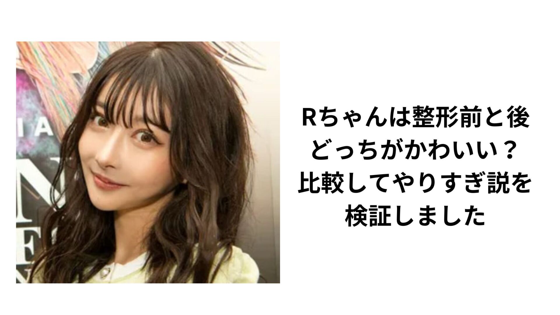 Rちゃんの整形前は別人？昔の写真・卒アルと総額3000万の全貌