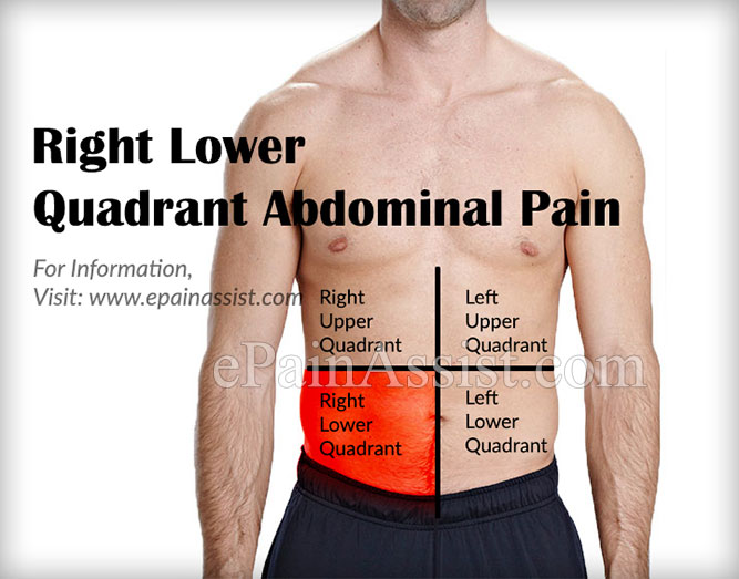 Pain Right Side Lower Abdomen Male