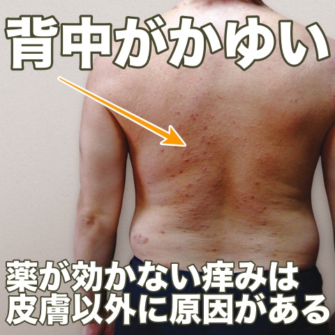 【熱愛】 背中 の かゆみ 肝臓 経歴＆学歴まとめ 2026 #716