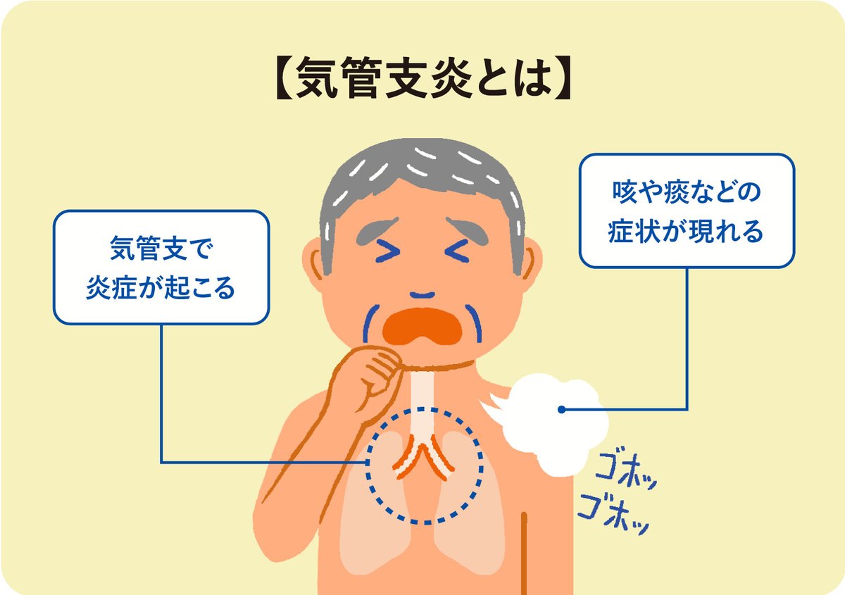 急性気管支炎と風邪の決定的な差！長引く咳の正体と治るまでの全手順